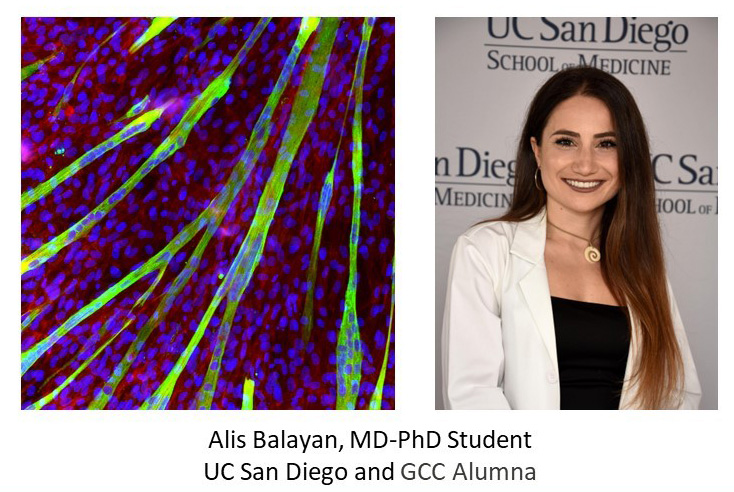 Alis Balayan, MD-PhD student, UC San Diego and GCC alumna